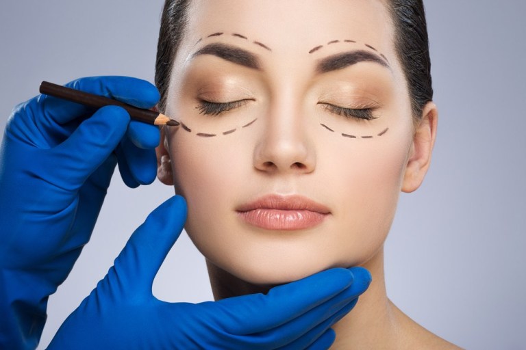 Blepharoplasty